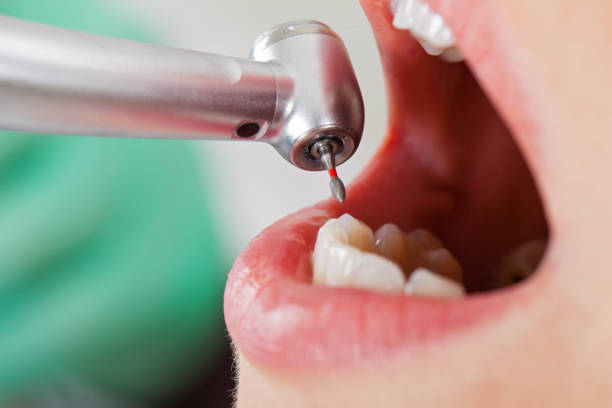 Best Root Canal Emergency Dentist  in Whitewright, TX